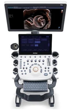 SonoScape P20