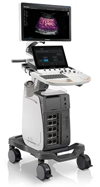 SonoScape P60